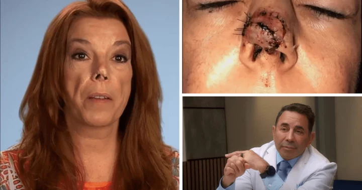 'Botched' Season 8: Where is Carolina now? Dr Paul Nassif helps single mom and dog-bite victim regain confidence