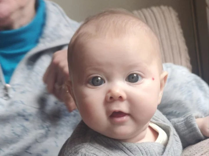 ‘My baby’s big blue eyes drew endless compliments – but they were the sign of a life-changing condition’