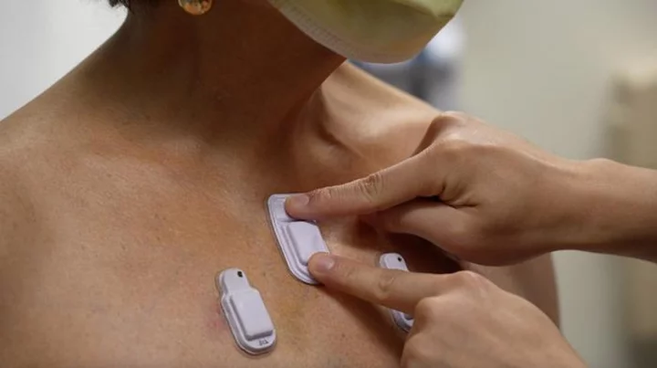 New wearable listens to belly gurgling and other bodily noises to monitor health